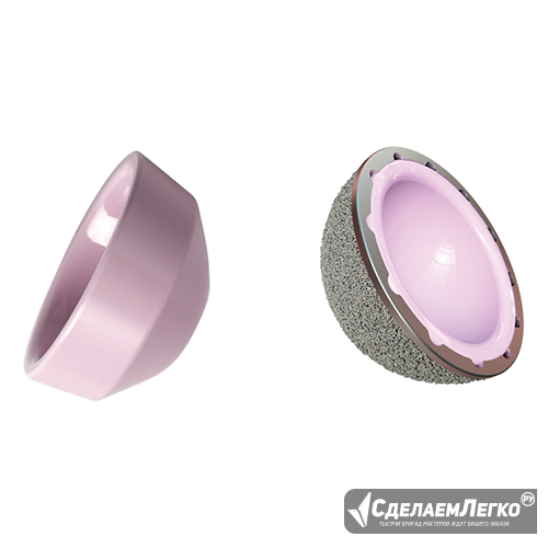 Керамический ацетабулярный вкладыш Москва - изображение 1