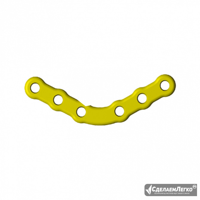 Угловая пластина (Реконструктивная) Москва - изображение 1