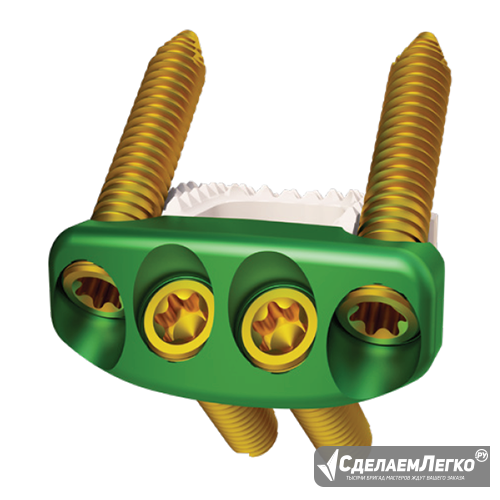 Поясничный межтеловой кейдж OLIF Москва - изображение 1