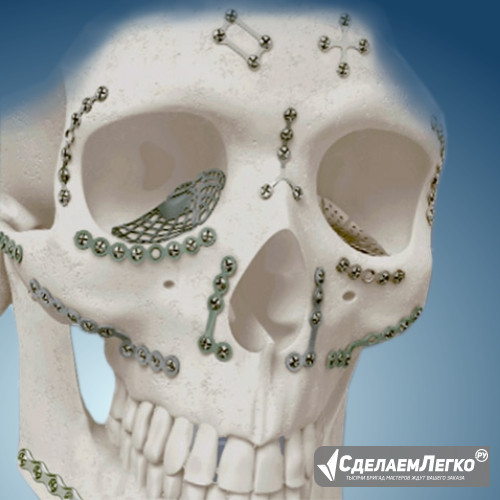 Челюстно-лицевая хирургия Москва - изображение 1