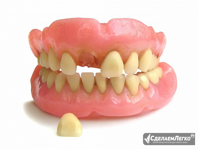 Ремонт при выпадении зуба из протеза Москва - изображение 1