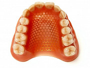 Армирование зубного протеза металлической сеткой Москва