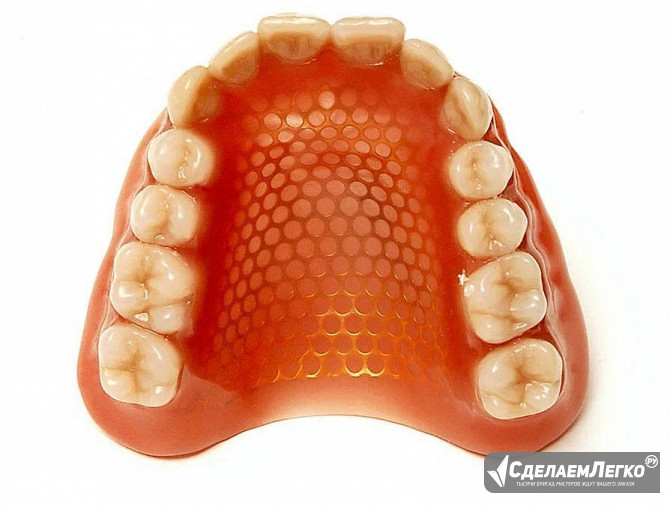 Армирование зубного протеза металлической сеткой Москва - изображение 1