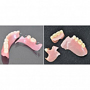 Ремонт съемного протеза при переломе кламмера Москва