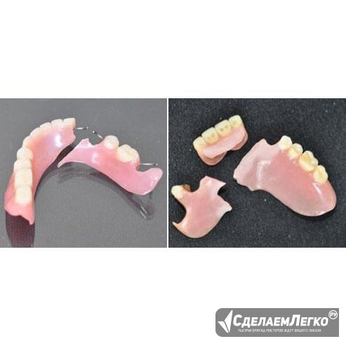 Ремонт съемного протеза при переломе кламмера Москва - изображение 1